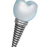 a tooth with a screw at the bottom instead of the usual tooth roots