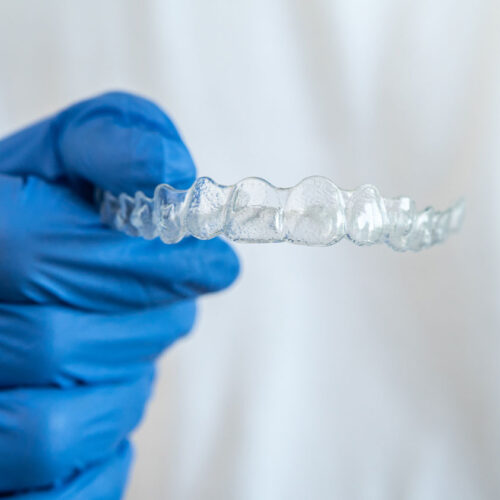Hand with blue gloves holding Invisalign Aligners retainer.