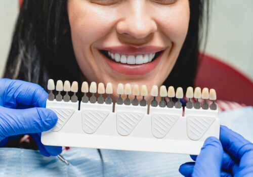 Close up of a woman smiling showing her teeth with hand hold dental veneers.
