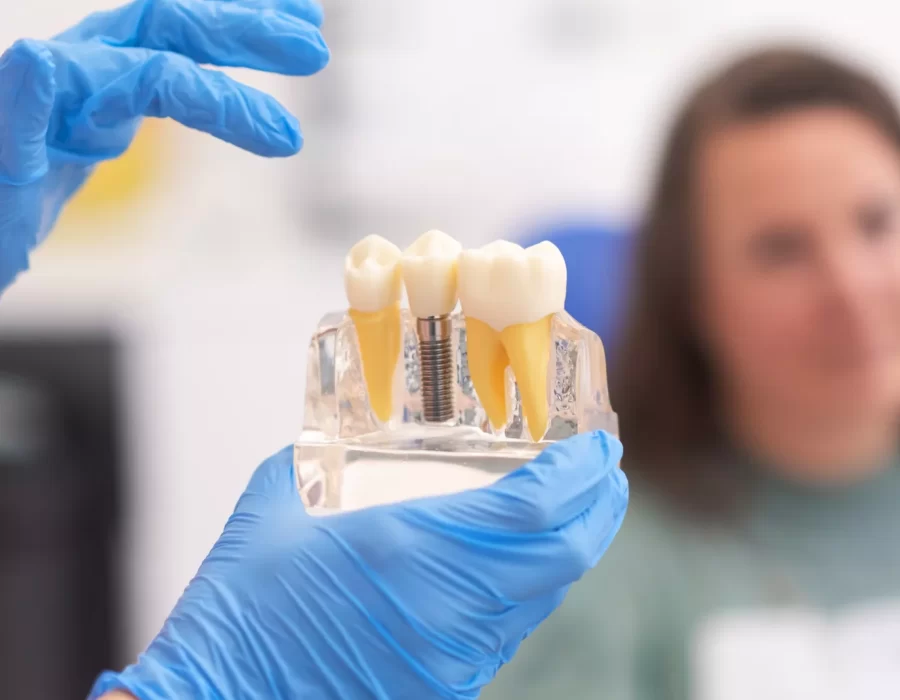 dental implants in San Gabriel, CA