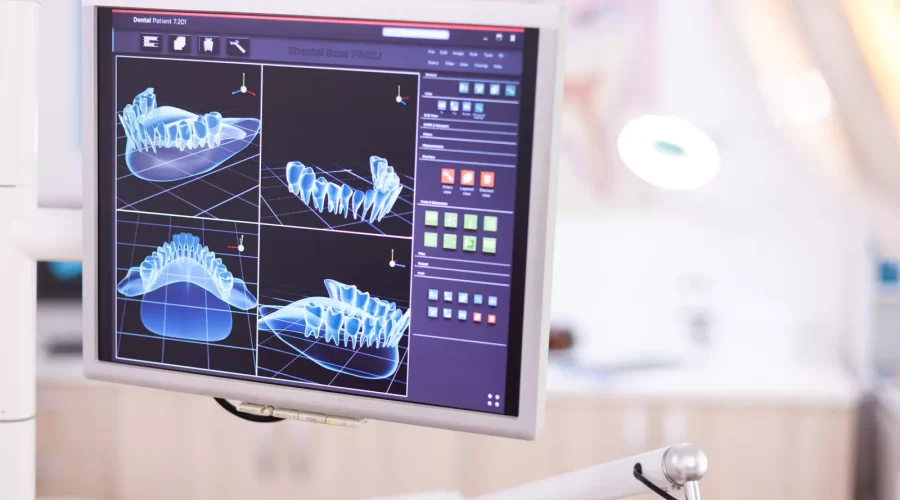 Advanced Technology for Invisalign and Smile Precision