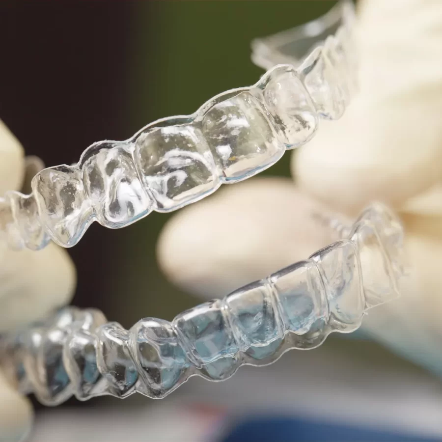 Invisalign Aligners