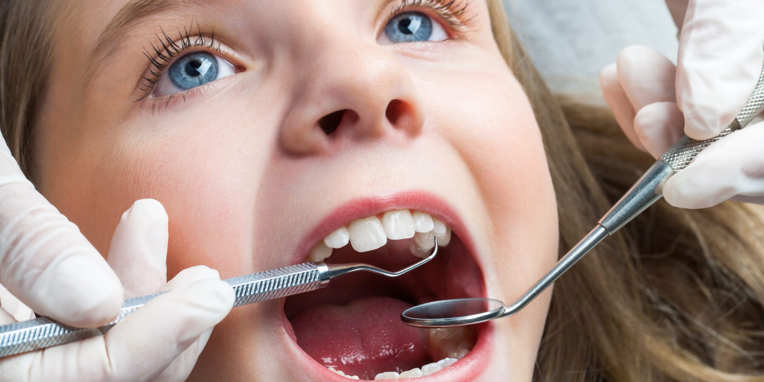 Dentist looking for cavaties in a child's mouth