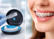 Invisalign vs braces