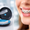 Invisalign vs braces