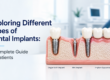 Featured image for different types of dental implants