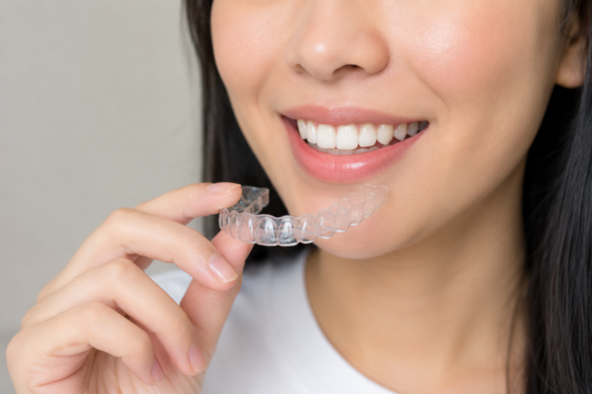 How to straighten teeth without braces
